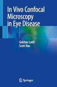 In Vivo Confocal Microscopy in Eye Disease (Repost)