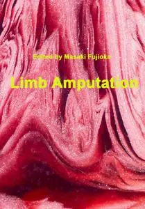 "Limb Amputation" ed. by Masaki Fujioka