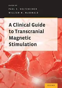 A Clinical Guide to Transcranial Magnetic Stimulation (Repost)