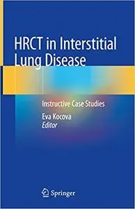 HRCT in Interstitial Lung Disease: Instructive Case Studies (repost)