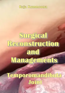 "Surgical Reconstruction and Managements: Temporomandibular Joint" ed. by Raja Kummoona