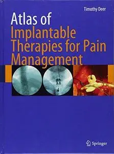 Atlas of Implantable Therapies for Pain Management