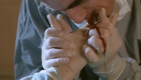 Rabid (1977)