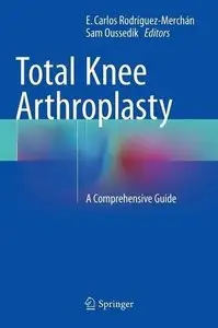 Total Knee Arthroplasty: A Comprehensive Guide (Repost)