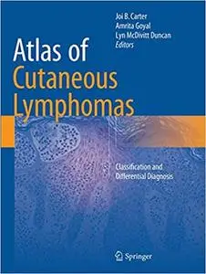 Atlas of Cutaneous Lymphomas: Classification and Differential Diagnosis (Repost)