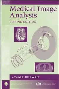 Medical Image Analysis, Second Edition (Repost)