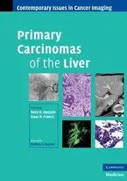 Primary Carcinomas of the Liver (Contemporary Issues in Cancer Imaging)