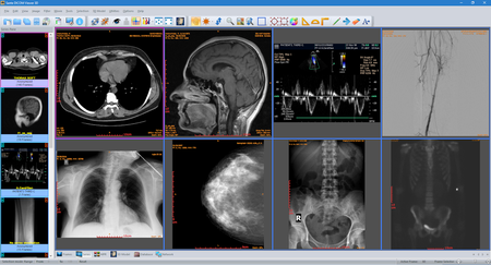 Sante DICOM Viewer 3D Pro 4.9.3