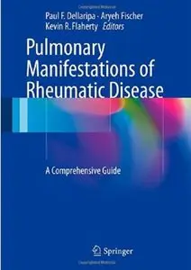 Pulmonary Manifestations of Rheumatic Disease: A Comprehensive Guide [Repost]