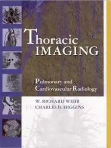 Thoracic Imaging: Pulmonary and Cardiovascular Radiology (Repost)