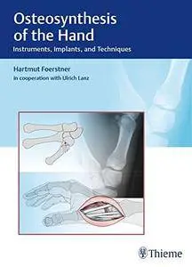 Osteosynthesis of the Hand