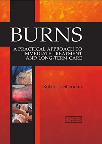 Burns: A Practical Approach to Immediate Treatment and Long Term Care