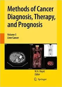 Methods of Cancer Diagnosis, Therapy, and Prognosis: Liver Cancer