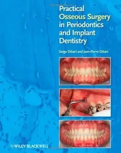 Practical Osseous Surgery in Periodontics and Implant Dentistry (Repost)