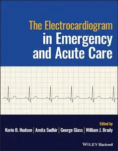 The Electrocardiogram in Emergency and Acute Care