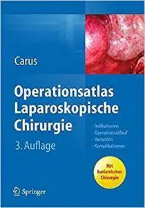 Operationsatlas Laparoskopische Chirurgie: Indikationen - Operationsablauf - Varianten - Komplikationen (Repost)