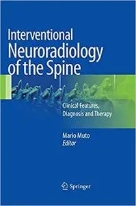 Interventional Neuroradiology of the Spine: Clinical Features, Diagnosis and Therapy