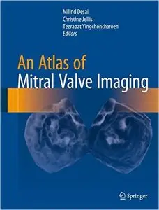An Atlas of Mitral Valve Imaging (Repost)