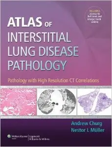 Atlas of Interstitial Lung Disease Pathology: Pathology with High Resolution Ct Correlations (Repost)