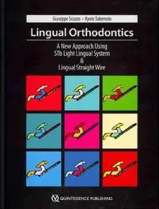 Lingual Orthodontics: A New Approach Using STb Light Lingual System and Lingual Straight Wire