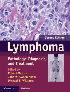 Lymphoma: Pathology, Diagnosis, and Treatment, 2 edition (repost)