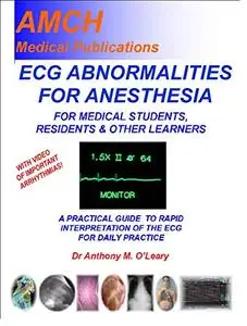 ECG ABNORMALITIES FOR ANESTHESIA