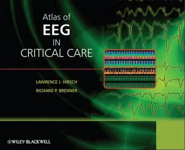 Atlas of EEG in Critical Care (repost)