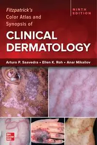 Fitzpatrick's Color Atlas and Synopsis of Clinical Dermatology, 9th Edition