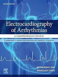 Electrocardiography of Arrhythmias (2nd Edition)