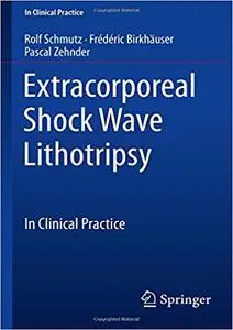 Extracorporeal Shock Wave Lithotripsy: In Clinical Practice