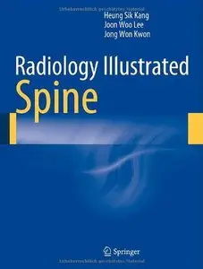 Radiology Illustrated: Spine