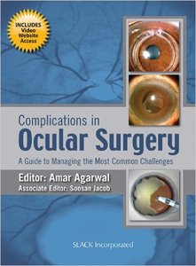 Complications in Ocular Surgery: A Guide to Managing the Most Common Challenges