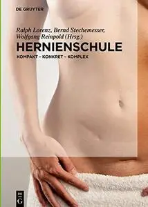 Hernienschule: Kompakt - Konkret - Komplex (German Edition)