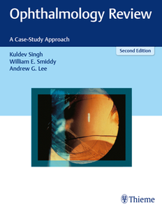 Ophthalmology Review : A Case-Study Approach, Second Edition