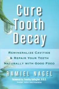 Cure Tooth Decay: Heal and Prevent Cavities with Nutrition (Repost)
