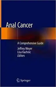 Anal Cancer: A Comprehensive Guide