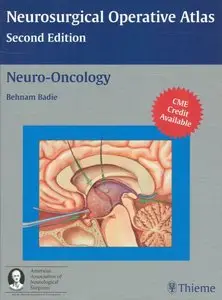 Neuro-Oncology (Neurosurgical Operative Atlas) (repost)