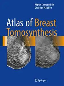 Atlas of Breast Tomosynthesis: Imaging Findings and Image-Guided Interventions (Repost)