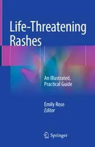 Life-Threatening Rashes: An Illustrated, Practical Guide