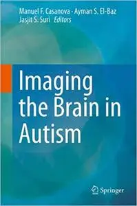 Imaging the Brain in Autism