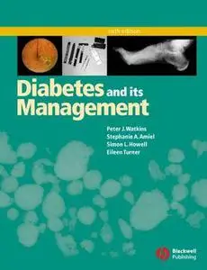 Diabetes and its Management, Sixth Edition