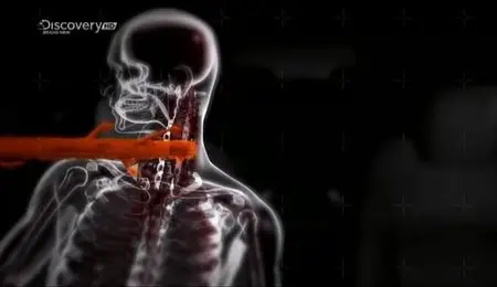 DC Body Invader's - Unwanted Guests (2012)