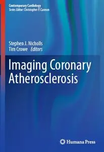 Imaging Coronary Atherosclerosis (repost)