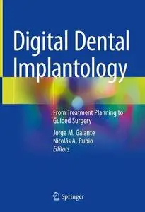 Digital Dental Implantology: From Treatment Planning to Guided Surgery