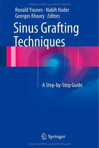 Sinus Grafting Techniques: A Step-by-Step Guide