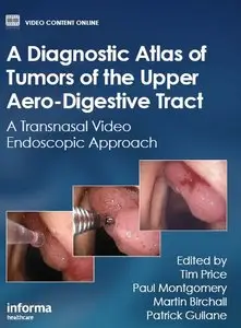 A Diagnostic Atlas of Tumors of the Upper Aero-Digestive Tract: A Transnasal Video Endoscopic Approach (repost)