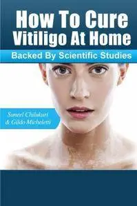 How To Cure Vitiligo at Home: (Backed by Scientific Studies)