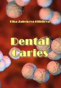 "Dental Caries" ed. by Efka Zabokova Bilbilova