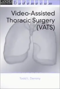 Video-Assisted Thoracic Surgery (Vademecum)