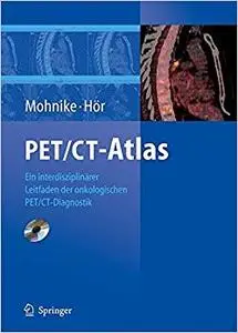 PET/CT-Atlas: Ein interdisziplinärer Leitfaden der onkologischen PET/CT-Diagnostik